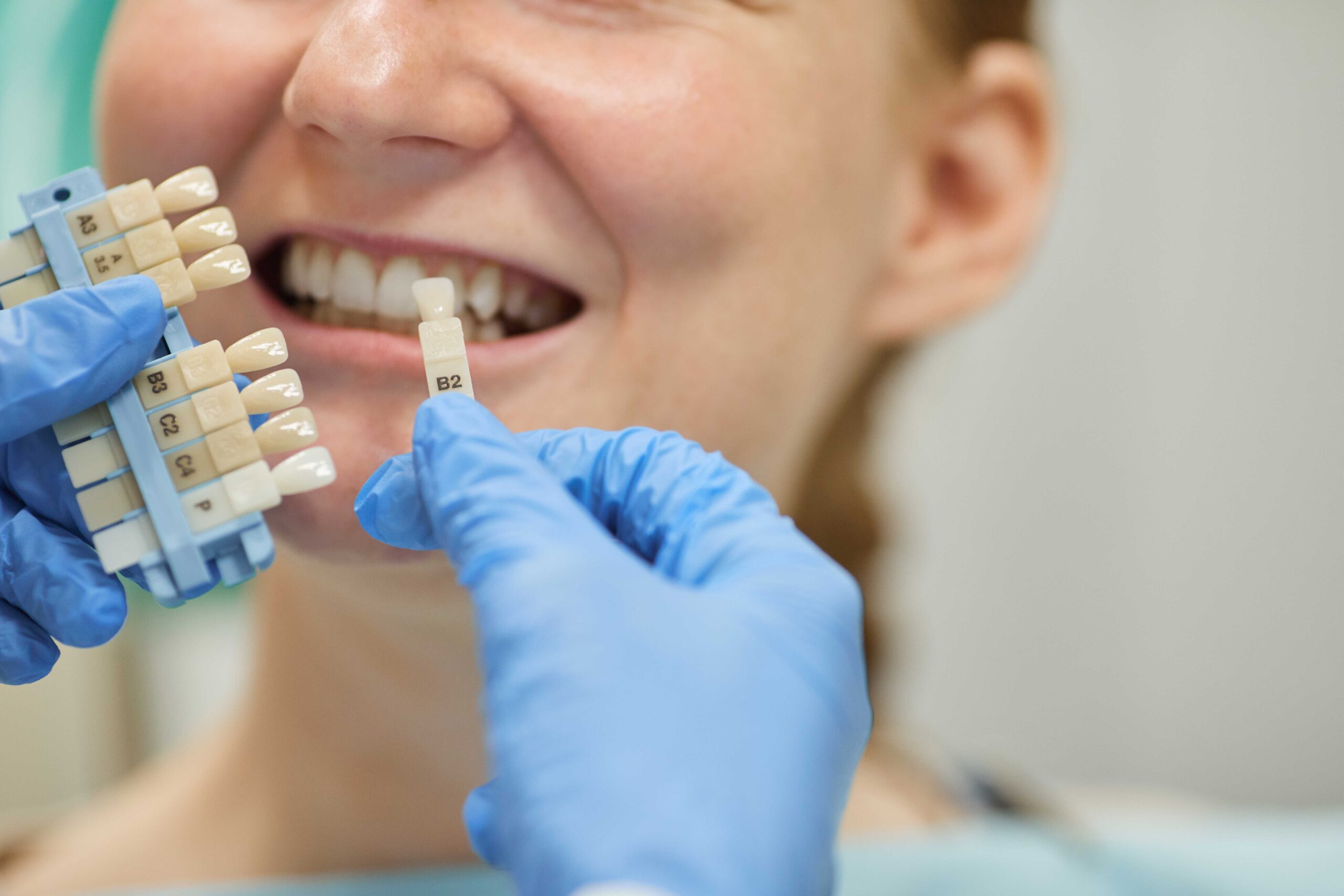 Dental Implant Success: What to Expect During the Procedure