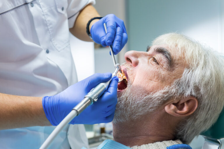 Stomatologist cleaning teeth