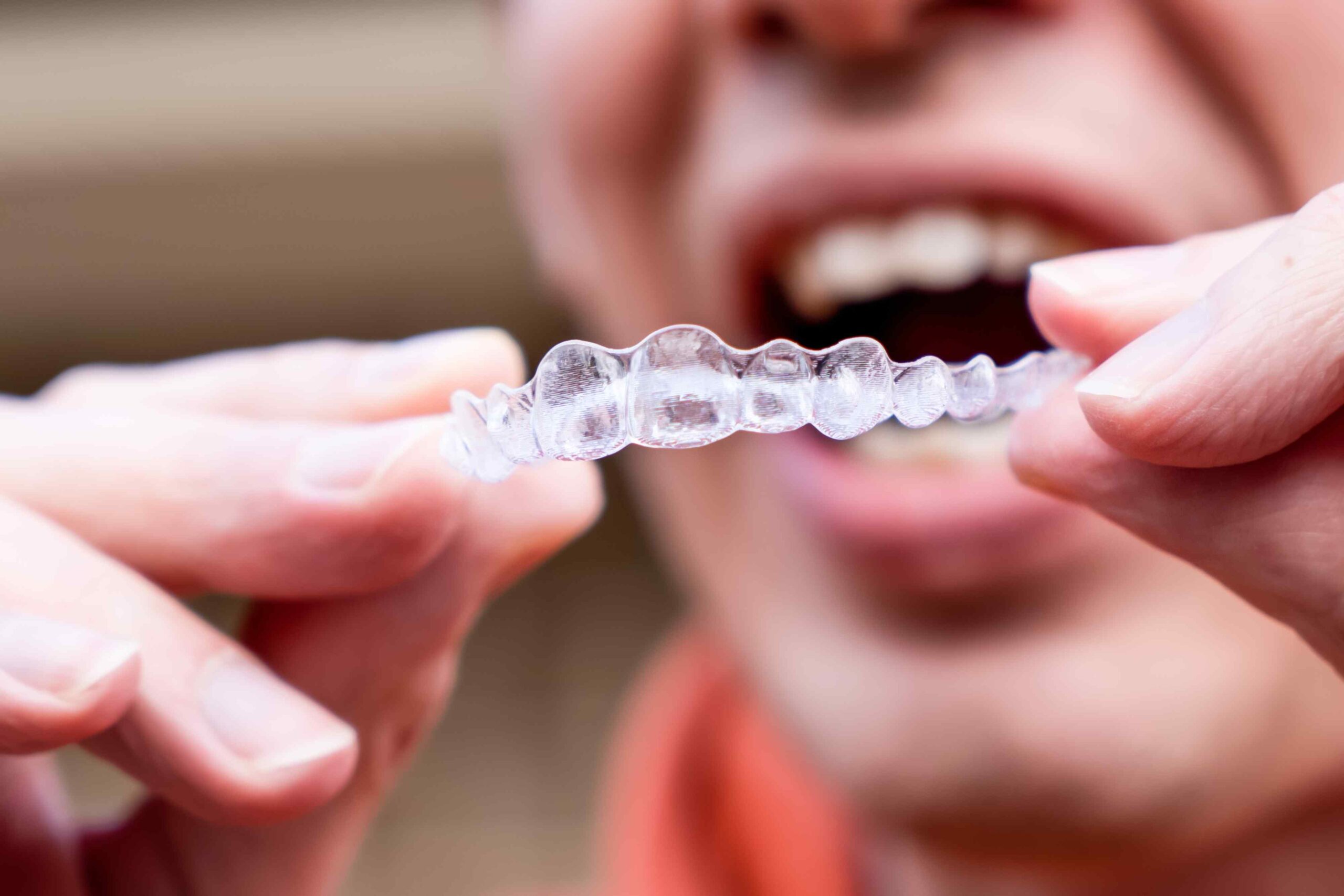 Invisalign for Adults Straighten Your Teeth Discreetly