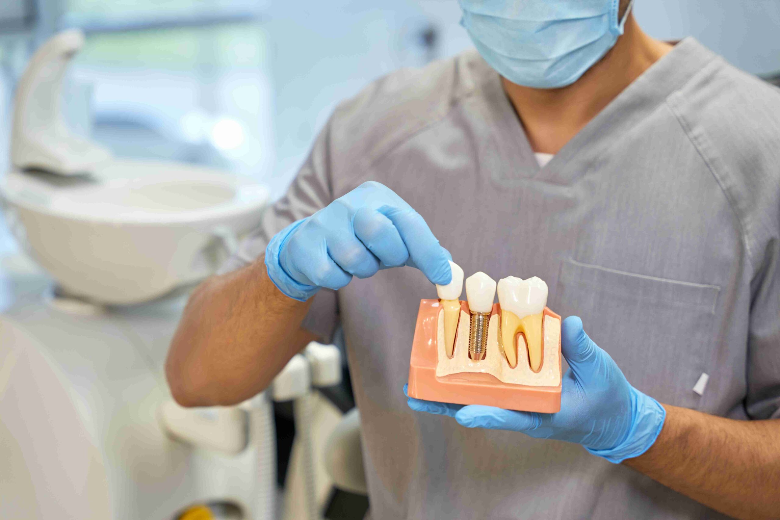 Replacing Missing Teeth Exploring Dental Implant Options